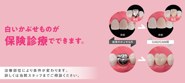 CAD/CAM�|�X�^�[