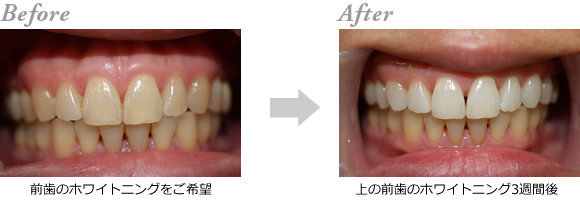 �z���C�g�j���O2