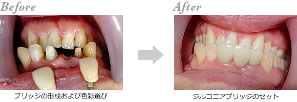 �W���R�j�A