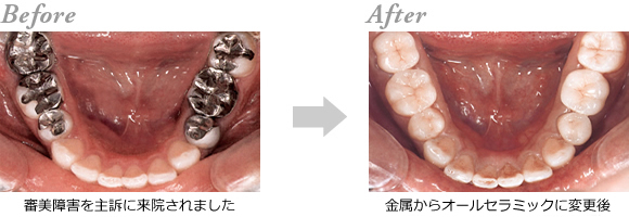 �I�[���Z���~�b�N