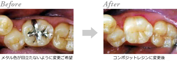 �R���|�W�b�g���W���C��1