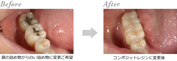 �R���|�W�b�g���W���C��2