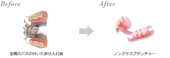 �m���N���X�v�f���`���[