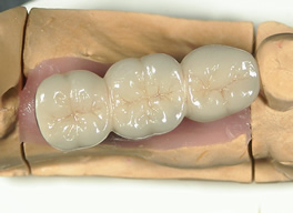 �C���v�����g�㕔�\��