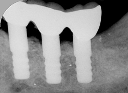 �C���v�����gX���摜