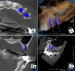 CT�V���~���[�V����