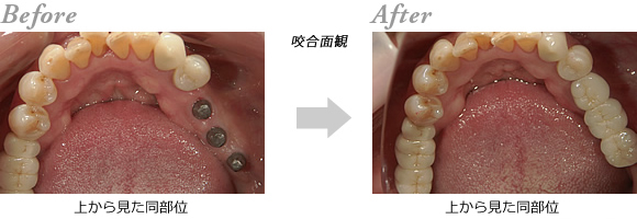 �C���v�����g4