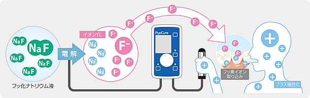 フッ素イオン導入2