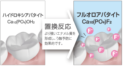 フッ素イオン導入3