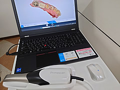 口腔内スキャナー2