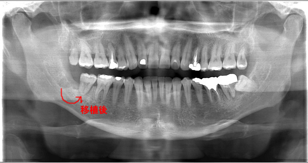 ���Ǝ���ڐA12