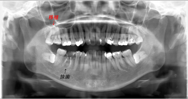 ���Ǝ���ڐA7