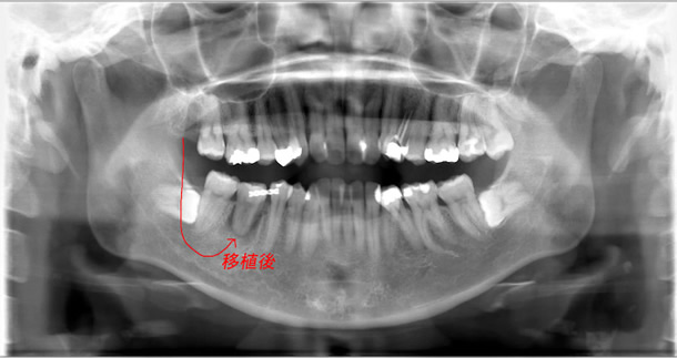 ���Ǝ���ڐA8